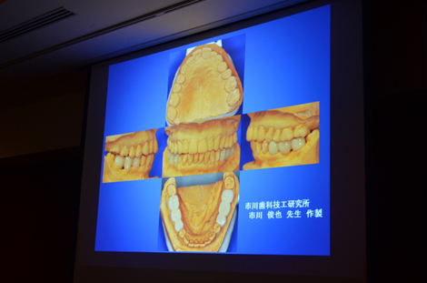 IPSG包括歯科医療研究会発信｜顎関節症、テレスコープシステムの専門家